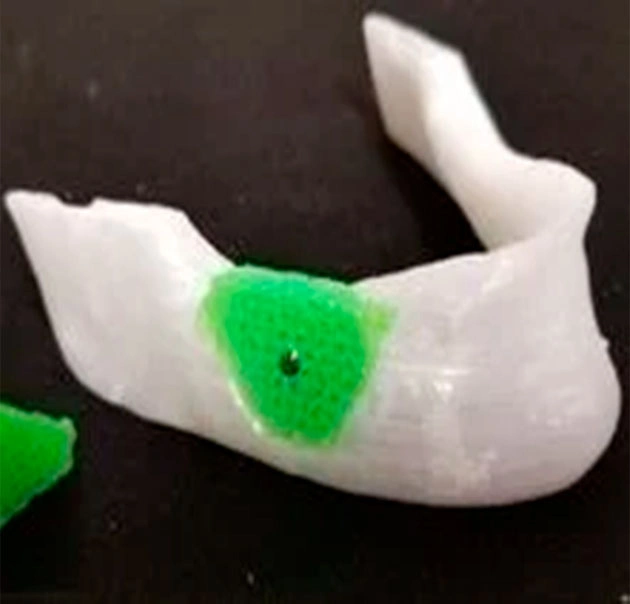 Aseptic 3d printing Aseptic 3d printing